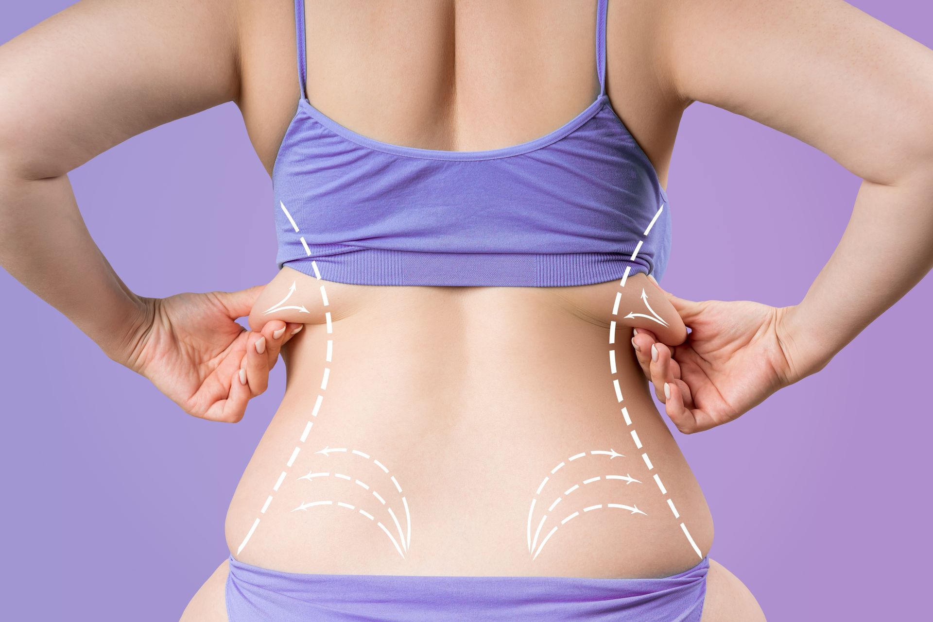 Fat reduction, and weight loss